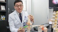 십자인대파열 운동선수만? 일반인도 주의 필요해 [건강 올레길]