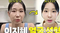 ‘46세’ 이지혜 “노화 실감해 실리프팅 시술”