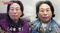‘87세’ 전원주, 500만 원 리프팅 시술…“10년만 젊어지고 싶다”