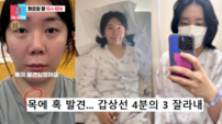 허안나, ‘박나래 여파’로 실직…차 사고·갑상선 수술까지 ‘악재’ (동상이몽2)