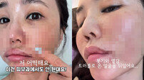 43세 강예빈 근황, 피부 다 뒤집어지고 난리나 ‘무슨 일’