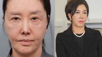 유혜리, 안면거상 시술 후 근황…동안 미모
