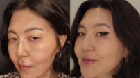 ‘44kg’ 한혜연, 16kg 감량 후 턱선 무너졌다…결국 시술 [SD셀픽]