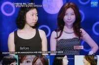 ‘렛미인’ 흔녀, 3580만 원 전신성형으로 ‘S라인 미인’
