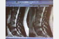 박원순 시장 아들 병역 논란 재점화…"병무청 제출 척추MRI 다른 사람 것?"