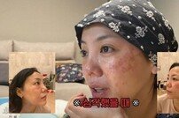 [DA:리뷰] 고은아 “피부 알레르기→얼굴 뒤집혀, 인생 최악”