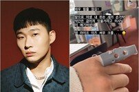 스윙스, 평생 손가락 굽어 있다 “힘줄 끊겨” 봉변 [DA★]