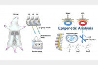 자생한방병원 “퇴행성 허리디스크, 유전보다 후천적 노화 밀접”