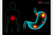 위내시경 검사, 위암 조기 발견의 열쇠 [건강 올레길]