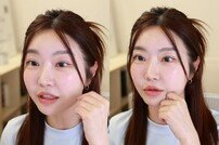 레이디 제인, 달라진 얼굴 근황…“쌍커풀 수술 10분만에 끝”