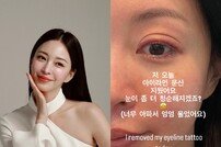 한예슬, 아이라인 문신 제거 근황…“아파서 펑펑 울어” [DA★]