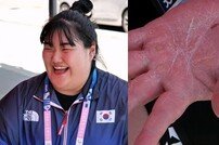 ‘299kg 들어 올린’ 박혜정, 굳은살 가득…갈라진 손바닥 (사당귀)