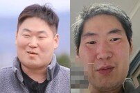 19기 영철, 영상 속 충격 근황…삽관 흔적도 [DA:이슈]