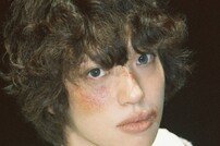 니엘, 입술 다 터지고…멍투성이 얼굴+아련 눈빛
