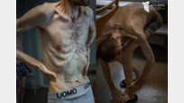 “뼈만 남았다” 2년만에 돌아온 우크라 포로의 처참한 몰골