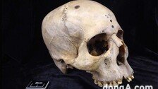 “4600년 전 사람 두개골에서 뇌암 수술·연구 증거 발견”