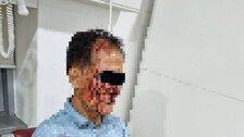 “코뼈 부러뜨리고 피범벅 만들어”…만취한채 택시기사 폭행한 50대 男 [e글e글]