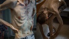 “뼈만 남았다” 2년만에 돌아온 우크라 포로의 처참한 몰골