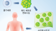 인슐린 주사 없는 당뇨 줄기세포 치료, 내년 시험