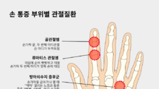 27개 뼈로 이뤄진 손…통증 부위별 의심되는 관절 질환은?