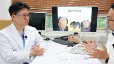 탈모엔 먹는 약이 가장 효과… 하루 두번 머리 감아야[이진한 의학전문기자의 메디컬 체험]