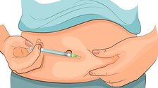 위에서 인슐린 만드는 기술 개발… ‘1형 당뇨’ 치료 길 연다