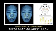 설탕·밀가루만 먹었더니…피부과 의사 피부 나이 5년 늙었다