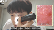 “7일 만에 피부 나이 ‘5살’ 폭삭” 피부과 의사, 직접 실험한 결과는?