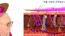 KAIST “모자처럼 쓰는 OLED 치료기로 탈모 막아요”