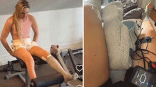 다리 잃을 뻔한 린지 본 “하루하루 버텨”…근황 공개(영상)