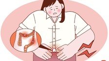 젊은층 노리는 ‘크론병’…배탈로 여겨 방치하기 일쑤
