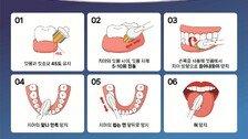 시큰시큰한 잇몸, 원인은 수면부족… “이렇게 예방해요”