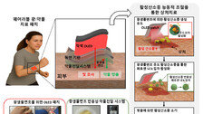 상처에 빛 쬐어 약물량 조절 ‘OLED 패치’ 개발