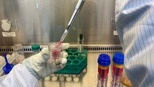 인공관절 늦춰주는 ‘이 주사’ 치료…“고령층에게도 효과”
