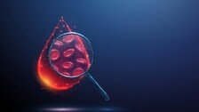 ‘피 한 방울’로 알츠하이머 예측, 치매 단계도 분석