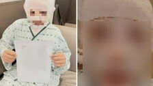 끓는 물 부은 남편 감쌌던 아내 “처벌 원해” 마음 바꿨다