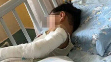 “엄마 오는지 보려” 11층서 추락한 4살 아이, 기적적 생존