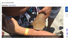상어에 물린 여성, 상어 때문에 살 수 있었다고?
