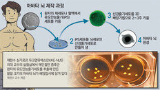 [단독]불가능했던 ‘뇌 조직검사’ 길 열려… 뇌질환 치료 획기적 진전