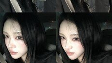 고 최진실 딸 최준희, “태초의 입술로 돌아갔다”…필러 제거 근황