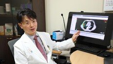 [인하대병원 메디 스토리]수술 어려운 폐암 환자, 방사선으로 종양 추적 제거