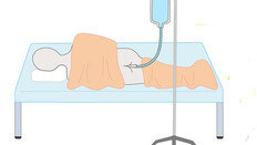 ‘엉덩이로 인공호흡’ 엉뚱 발상, 첫 인체 시험 성공