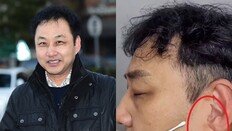 김수용 귓불 주름=심근경색 전조?…전문의 “인과관계 없어” 일축