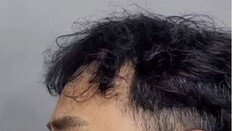 “김수용 귓불 주름, 심근경색 전조? 노화현상”…전문의 진단