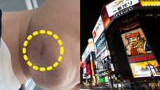 [단독] “앞니 3개 부러지고 피범벅” 韓관광객 日서 집단폭행 당해