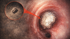 무심코 들이마신 ‘먼지 한 톨’…5년 뒤 폐 잃었다