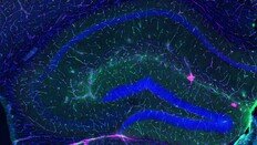 운동이 뇌를 보호하는  ‘생물학적 기전’ 발견[노화설계]