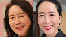 64세 윤영미 확 바뀐 외모…“용기 내길 잘했다 생각” [노화설계]