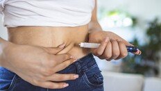 “살은 빠졌는데 병뚜껑도 못 연다”…비만주사 뒤 ‘근손실 공포’ 왜