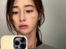 ‘이병헌♥’ 이민정 “씻기 전에…” 얼굴 상처 왜? [DA★]
